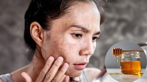 चेहरे से झाइयां हटाने के लिए शहद का इन 3 तरीकों से करें इस्तेमाल, फेस पर आएगा इंस्टेंट निखार