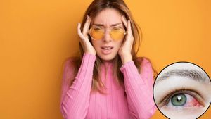 Summer Eye Care Tips: बढ़ती गर्मी से आंखों में बढ़ा इंफेक्शन का खतरा, जानें लक्षण और बचाव के उपाय