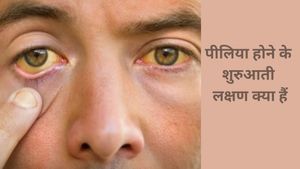 गर्मियों में पीलिया होने की मुख्य वजह क्या है? जानें कारण, लक्षण और बचाव के उपाय