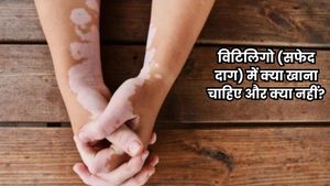 World Vitiligo Day 2026: विटिलिगो (सफेद दाग) में क्या खाना चाहिए और क्या नहीं? जानिए एक्सपर्ट से