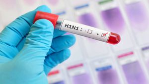 दिल्ली में बढ़े H1N1 (स्वाइन फ्लू) के मामले, अब तक 1344 केस, ये लक्षण दिखें तो बिल्कुल नजरअंदाज न करें