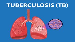 World Tuberculosis Day 2026: Date, Theme, History, and Significance Explained