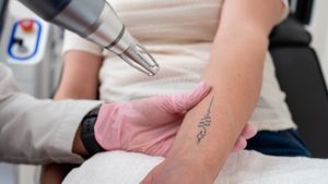 Tattoo Regret Is Rising: What Plastic Surgeons Want You to Know Before You Remove Your Ink