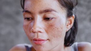 Melasma, Tanning, Early Wrinkles: Expert Explains How Daily Sun Exposure Quietly Ages Your Skin