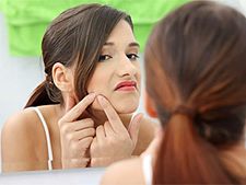 ಚೆಂದುಳ್ಳಿ ಚೆಲುವೆಗೆ ಮೊಡವೆಯ ನಂಟೇಕೆ? 