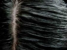 ಯಾವತ್ತಿಗೂ ಬಳಸಬೇಡಿ  'ಬ್ಲ್ಯಾಕ್ ಹೆನ್ನಾ' 