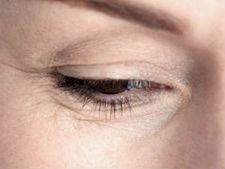 ಟಿವಿ ನೋಡಿದರೆ ಅಕಾಲಿಕ ನೆರಿಗೆ ಬೀಳುವುದೇ? 