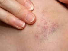 ಈ ರೀತಿಯ ಗಾಯ ತುಂಬಾ ಅಪಾಯಕಾರಿ!