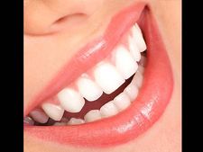 ಹಳದಿ ಹಲ್ಲುಗಳಿಗೆ ಗುಡ್ ಬೈ ಹೇಳಬೇಕೆ?