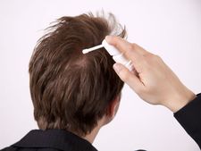 ಚಿಕ್ಕ ಪ್ರಾಯದಲ್ಲಿ ಕೂದಲು ಬಿಳಿಯಾಗಲು 10 ಕಾರಣಗಳು