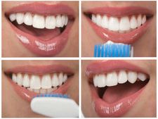 ಹಲ್ಲುಗಳು ಹಳದಿಯಾಗದಂತೆ  ತಡೆಯಬೇಕೆ?