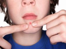 ಚಳಿಗಾಲದಲ್ಲಿ ತ್ವಚ್ಛೆಯ ಆರೈಕೆ