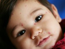 ಆರೋಗ್ಯ ಸುಧಾರಣೆಗೆ ಬೇವು ಸಹಕಾರಿ ಹೇಗೆ? 