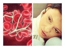 ದೇಹದಲ್ಲಿ ರಕ್ತದ ಪರಿಚಲನೆಯನ್ನು ಸುಧಾರಿಸಲು ಇಲ್ಲಿದೆ 14 ಮನೆಮದ್ದುಗಳು 