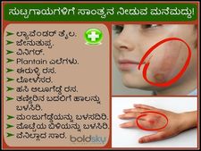 ನೋವು ತಂದೊಡ್ಡುವ ಸುಟ್ಟಗಾಯಗಳಿಗೆ ಸಾಂತ್ವನ ನೀಡುವ ಮನೆಮದ್ದು!