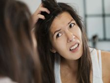 ಕೂದಲುದುರುವ ಸಮಸ್ಯೆ- ಮಹಿಳೆಯರ ಸಂಖ್ಯೆಯೇ ಜಾಸ್ತಿ!