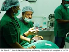 ಹೇರ್‌ಲೈನ್ ಇಂಟರ್‌ನ್ಯಾಷನಲ್‌: ದಾಖಲೆಯ ಬೈಫಾಲಿಕ್ಯುಲರ್ ಕೂದಲ ಕಸಿ