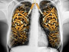 ಅಧ್ಯಯನ ವರದಿ: ಧೂಮಪಾನದ ಬಿಗಿ ಮುಷ್ಟಿಗೆ ವಿಶ್ವವೇ ನಲುಗುತ್ತಿದೆ! 