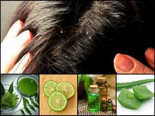 ಕಿರಿಕಿರಿ ನೀಡುವ ತಲೆಹೊಟ್ಟಿನ ಸಮಸ್ಯೆಗೆ 'ಬೇವಿನ' ಹೇರ್‌ ಪ್ಯಾಕ್  