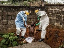 ಅಚ್ಚರಿ ಜಗತ್ತು: ಮೈ ನಡುಗಿಸುವ ವಿಚಿತ್ರ ಕಾಯಿಲೆಗಳಿವು! 