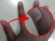 ಉಗುರಿನಲ್ಲಿ 'ಅರ್ಧಚಂದ್ರಾಕೃತಿ' ಇದ್ದರೆ-ಅದೃಷ್ಟವೇ ಬದಲಾಗಬಹುದು! 