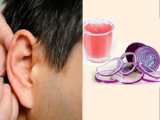 ಬೇಸಿಗೆಯ ಬಿಸಿಲ ಝಳದಿಂದ ಬಚಾವ್ ಆಗಲು ಸರಳೋಪಾಯ