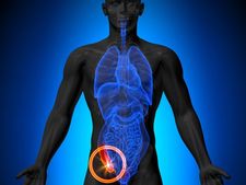 'ಅಪೆಂಡಿಕ್ಸ್' ಎಂಬ ದಿಢೀರ್ ರೋಗ! ಇದರ ಲಕ್ಷಣಗಳೇನು?    