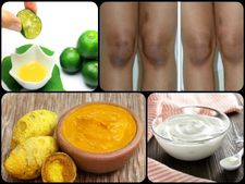 ಕೈ ಹಾಗೂ ಕಾಲಿನ ಗಂಟುಗಳ ಕಪ್ಪು ಕಲೆಗಳ ಸಮಸ್ಯೆಗೆ ಸರಳ ಟಿಪ್ಸ್