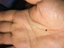 ದೇಹದ ಈ 8 ಸ್ಥಳಗಳಲ್ಲಿ ಮಚ್ಚೆ ಇದ್ದವರಿಗೆ, ಸ್ವಲ್ಪ ಹಣದ ಸಮಸ್ಯೆ ಕಾಡುತ್ತೆ!  