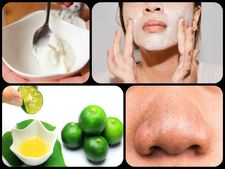 ಮೊಡವೆ ಸಮಸ್ಯೆಗೆ ಇಲ್ಲಿದೆ ನೋಡಿ ಮನೆಮದ್ದು-ಎಲ್ಲಾ ಸರಿ ಹೋಗುತ್ತೆ...