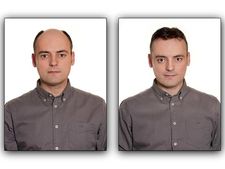 ಬೊಕ್ಕ ತಲೆಯಲ್ಲಿ ಕೂಡಲೇ ಕೂದಲು ಚಿಗುರಿಸುವ ಮನೆ ಮದ್ದುಗಳು