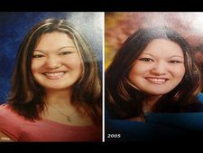 ಖತರ್ನಾಕ್ ಕಾಯಿಲೆ ಎದುರಿಸಿ, ಕೊನೆಗೂ ಆಕೆ ರೂಪದರ್ಶಿಯಾದಳು! 