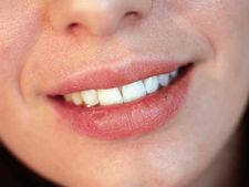 ತುಟಿ ಒಣಗಿದೆಯೇ? ಹಾಗಿದ್ದರೆ ಇವುಗಳಿಂದ ಮಸಾಜ್ ಮಾಡಿ