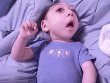 ಅಚ್ಚರಿ ಜಗತ್ತು: ಯಾವ ತಾಯಿಗೂ ಇಂತಹ ವಿಚಿತ್ರ ಮಗು ಹುಟ್ಟದಿರಲಿ