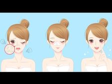 ವೈಟ್ ಹೆಡ್‌ ಸಮಸ್ಯೆಯೇ? ಹಾಗಾದರೆ ಇಲ್ಲಿದೆ ನೋಡಿ ಪವರ್ ಫುಲ್ ಮನೆಮದ್ದುಗಳು 