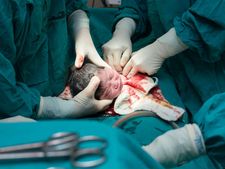 ಹೆರಿಗೆ ವೇಳೆ ನರ್ಸ್ ಮಾಡಿದ ಎಡವಟ್ಟು- ತಾಯಿಯ ಹೊಟ್ಟೆಯಲ್ಲಿ ತಲೆ, ಉಳಿದ ಭಾಗ ಹೊರಗೆ!! 