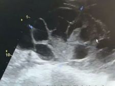 ಐಫೋನ್ ಖರೀದಿಗೆ ಅಂಡಾಣು ಮಾರಲು ಮುಂದಾದಳು! ಕೊನೆಗೆ ಏನಾಯಿತು ಗೊತ್ತೇ?  