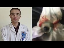 ಕುಡಿದ ಮತ್ತಿನಲ್ಲಿ ತನ್ನ ಕಣ್ಣಗುಡ್ಡೆಗಳನ್ನು ಕಳೆದುಕೊಂಡರೂ, ಆತನಿಗೆ ಗೊತ್ತೇ ಆಗಿಲ್ಲವಂತೆ!! 