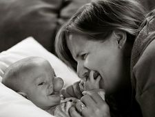 ಈ ಮಗು ಗರ್ಭದಲ್ಲಿರುವಾಗಲೇ ತಲೆಬುರುಡೆಯಿಂದ ಹೊರಗಡೆ ಮೆದುಳು ಬೆಳೆಯಿತಂತೆ! 