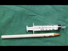 ಬಾಲಕನ ಕಣ್ಣಿನಲ್ಲಿ ಸಿಲುಕಿದ ಪೆನ್ಸಿಲ್!  ಅದೃಷ್ಟವಶಾತ್ ದೃಷ್ಟಿ ಕಳೆದುಕೊಳ್ಳದೇ ಪಾರಾದ 