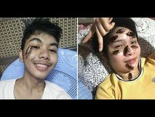 ಇಂಟರ್ನೆಟ್‌ನಲ್ಲಿ ವೈರಲ್ ಆಗಿದೆ ಜಿರಳೆಗಳನ್ನು ಮುಖದ ಮೇಲೆ ಹಾಕಿಕೊಳ್ಳುವ ಚಾಲೆಂಜ್!! 