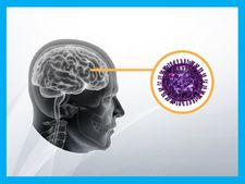 ಎನ್ಸೆಫಲೈಟಿಸ್: ಬಿಹಾರದ ನೂರಕ್ಕೂ ಮಕ್ಕಳನ್ನು ಬಲಿ ತೆಗೆದುಕೊಂಡ ಮಾರಣಾಂತಿಕ ಕಾಯಿಲೆ 