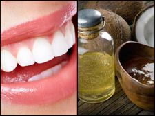 ಆರೋಗ್ಯ ಟಿಪ್ಸ್: ಹಲ್ಲುಗಳ ಆರೈಕೆಗೆ ಬಳಸಿ 'ತೆಂಗಿನ ಎಣ್ಣೆ'! 