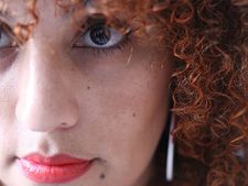 ಏನಿದು ಗರ್ಭಾವಸ್ಥೆಯಲ್ಲಿ ಕಾಡುವ ಮೆಲಸ್ಮಾ ಸಮಸ್ಯೆ?