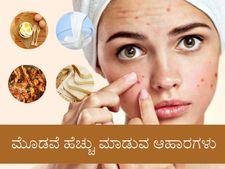 ಈ 10 ಆಹಾರಗಳನ್ನು ತಿಂದರೆ ಮೊಡವೆ ಸಮಸ್ಯೆ ಮತ್ತಷ್ಟು ಹೆಚ್ಚುವುದು