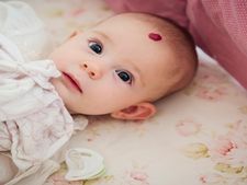 ಮಗುವಿನಲ್ಲಿ ಸ್ಟ್ರಾಬೆರಿ ರೀತಿಯ ಹುಣ್ಣು ಇದೆಯೇ? ನೀವು ತಿಳಿಯಲೇಬೇಕಾದ ಸಂಗತಿಗಳಿವು