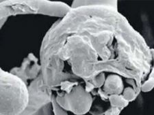  ಬ್ಲ್ಯಾಕ್‌ ಫಂಗಸ್‌ಗಿಂತ ವೈಟ್‌ಫಂಗಸ್ ಅಪಾಯಕಾರಿ: ತಡೆಗಟ್ಟುವುದು ಹೇಗೆ?