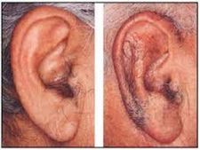 ಕಿವಿಯಲ್ಲಿ ಕೂದಲು ಬೆಳೆಯುವುದಕ್ಕೂ, ಆರೋಗ್ಯಕ್ಕೂ ಏನು ಸಂಬಂಧ? ಇದಕ್ಕೆ ಕಾರಣವೇನು?