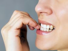 ಉಗುರು ಕಡಿಯುವ ಅಭ್ಯಾಸವನ್ನು ಬಿಡಲು ಇಲ್ಲಿವೆ ಸರಳ ಟಿಪ್ಸ್‌ಗಳು