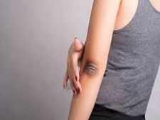 ಕಪ್ಪು ಮೊಣಕೈ, ಮೊಣಕಾಲುಗಳಿಗೆ ಸರಳ ಮನೆಮದ್ದುಗಳು 